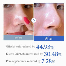 Indlæs billede til gallerivisning Medicube Zero Pore Pad 2.0 – eksfolierende toner pads Gua-sha.dk