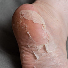 Indlæs billede til gallerivisning Exfoliating Peeling Socks ( dem hvor huden skaller af ) Gua-sha.dk