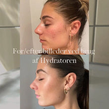 Indlæs billede til gallerivisning Kyst Care Hydrator serum - 30 ml Gua-sha.dk