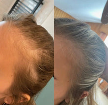 Indlæs billede til gallerivisning Yuaia Rosemary Hair &amp; Scalp Oil – Stimulerer hårvækst &amp; plejer hovedbunden (50 ml) Gua-sha.dk
